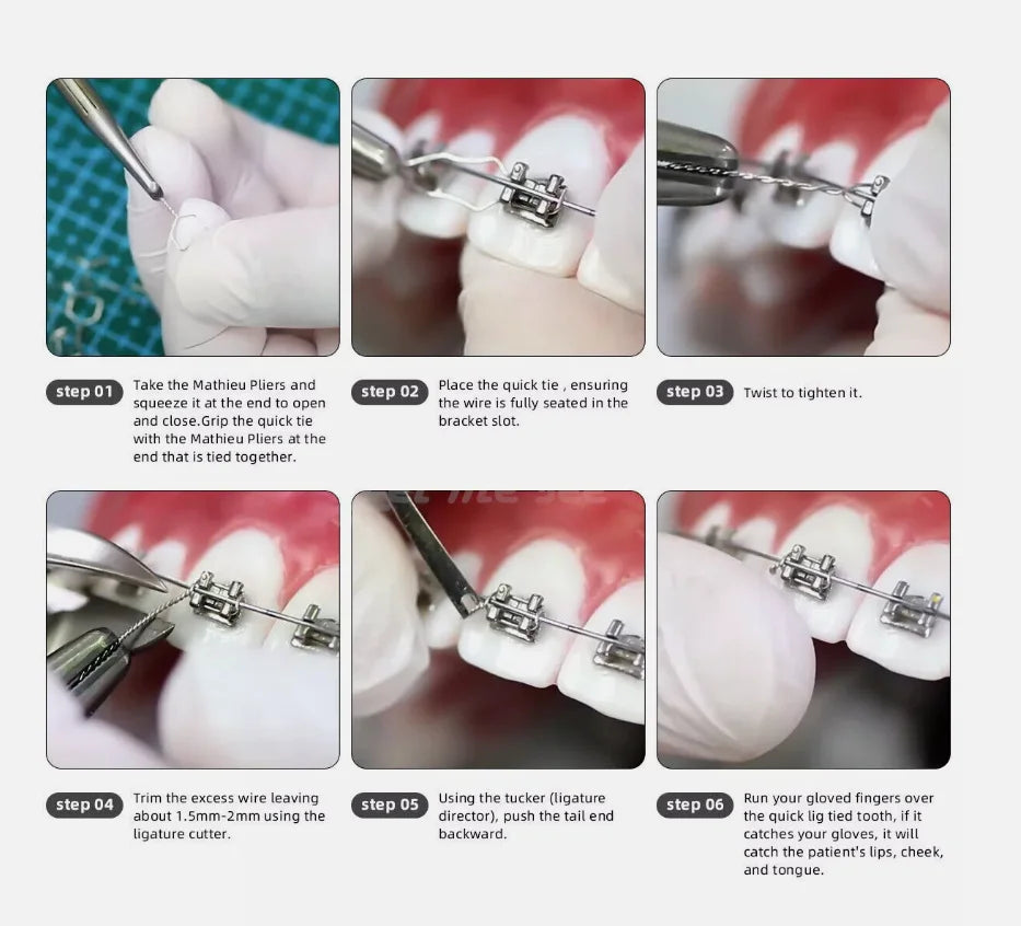 100Pcs/Pack Dental Orthodontic Kobayashi Wire Preformed Ligature Wire  Long Short Twist Weld 0.008-0.014 for Metal Bracket Brace